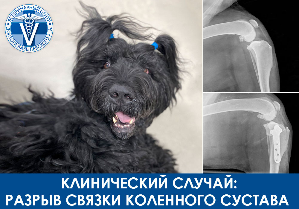 Лечение разрыва передней крестообразной связки коленного сустава